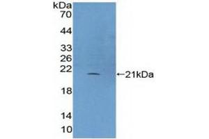 Detection of Recombinant PLCb3, Human using Polyclonal Antibody to Phospholipase C Beta 3, Phosphoinositide Specific (PLCb3) (Phospholipase C beta 3, Phosphoinositide Specific (AA 318-468) Antikörper)