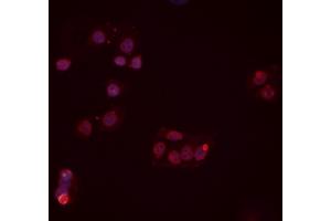 ABIN6277454 staining Hela cells by IF/ICC. (PPP2CB Antikörper  (C-Term))