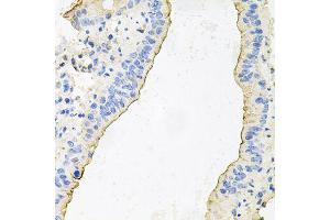 Immunohistochemistry of paraffin-embedded mouse lung using HPR antibody (ABIN6003630) at dilution of 1/100 (40x lens). (HPR Antikörper)