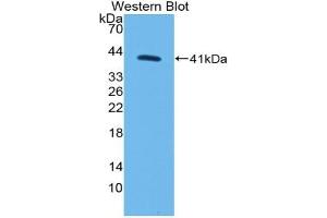 Detection of Recombinant MYO5A, Human using Polyclonal Antibody to Myosin VA (MYO5A) (MYO5A Antikörper  (AA 1531-1855))