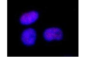 Immunofluorescence (IF) image for anti-SWI/SNF Related, Matrix Associated, Actin Dependent Regulator of Chromatin, Subfamily A, Member 4 (SMARCA4) (C-Term) antibody (ABIN2451926) (SMARCA4 Antikörper  (C-Term))