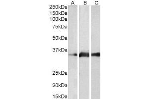 ABIN2563589 (2µg/ml) staining of Human Brain (Cerebellum) (A), Mouse Brain (B) and Rat Brain (C) lysates (35µg protein in RIPA buffer). (Kallikrein 5 Antikörper  (Internal Region))