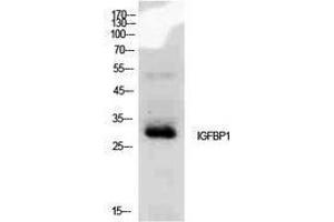 Western Blotting (WB) image for anti-Insulin-Like Growth Factor Binding Protein 1 (IGFBPI) (Internal Region) antibody (ABIN3188011) (IGFBPI Antikörper  (Internal Region))