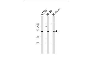 All lanes : Anti-B Antibody (Center) at 1:2000 dilution Lane 1:  whole cell lysate Lane 2: HL-60 whole cell lysate Lane 3: Human uterus lysate Lysates/proteins at 20 μg per lane.