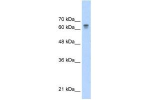 PARP6 antibody used at 0. (PARP6 Antikörper)