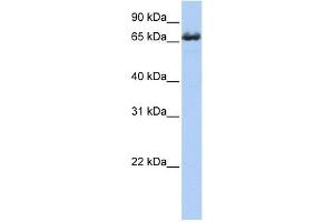 ZDHHC17 antibody used at 1 ug/ml to detect target protein. (ZDHHC17 Antikörper  (Middle Region))