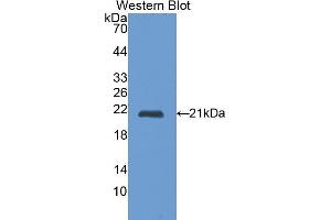 Detection of Recombinant CTSL, Rat using Polyclonal Antibody to Cathepsin L (CTSL) (Cathepsin L Antikörper  (AA 114-288))