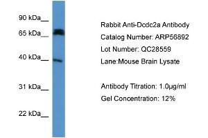 WB Suggested Anti-Dcdc2a  Antibody Titration: 0.