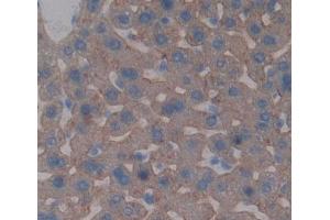 Used in DAB staining on fromalin fixed paraffin- embedded liver tissue (ABCG5 Antikörper  (AA 66-276))