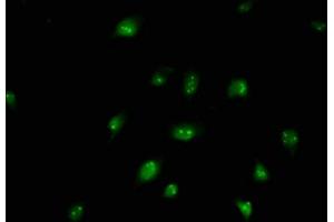 Immunofluorescence staining of U251 cells with ABIN7145872 at 1:250, counter-stained with DAPI. (BUD13 Antikörper  (AA 132-233))