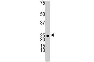 The KHK polyclonal antibody  is used in Western blot to detect KHK in 293 cell lysate . (Ketohexokinase Antikörper  (N-Term))