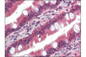Human Small Intestine (formalin-fixed, paraffin-embedded) stained with FGFR1at 4 µg/ml followed by biotinylated anti-goat IgG secondary antibody, alkaline phosphatase-streptavidin and chromogen. (FGFR1 Antikörper  (C-Term))