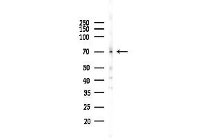 anti-Solute Carrier Family 6, Member 18 (SLC6A18) (Internal Region) antibody