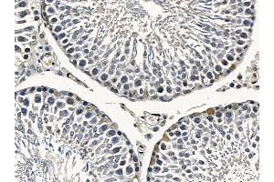 FOXO4 Mouse Monoclonal Antibody at 1/100 staining rat testis tissue by IHC-P. (FOXO4 Antikörper  (Internal Region))