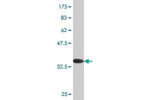 Western Blot detection against Immunogen (36. (MSRB2 Antikörper  (AA 102-201))