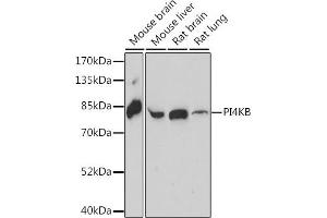 Western blot analysis of extracts of various cell lines, using PI4KB antibody (ABIN7269287) at 1:1000 dilution. (PI4KB Antikörper  (AA 560-801))