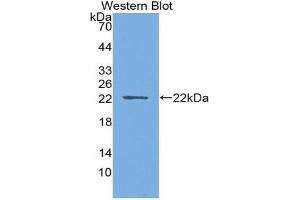 Detection of Recombinant PTHrP, Rat using Monoclonal Antibody to Parathyroid Hormone Related Protein (PTHrP)