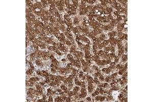 Immunohistochemical staining of human liver with NIT2 polyclonal antibody  shows strong cytoplasmic positivity in hepatocytes at 1:200-1:500 dilution.