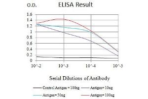 Black line: Control Antigen (100 ng),Purple line: Antigen (10 ng), Blue line: Antigen (50 ng), Red line:Antigen (100 ng) (GATA3 Antikörper  (AA 287-301))