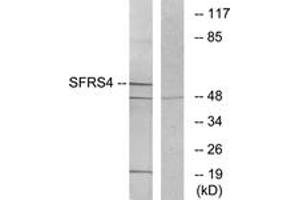 Western blot analysis of extracts from LOVO cells, using SFRS4 Antibody. (SRSF4 Antikörper  (AA 111-160))