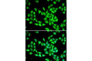 Immunofluorescence analysis of HeLa cell using PCMT1 antibody.