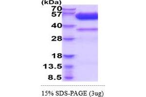 SDS-PAGE (SDS) image for Tumor Necrosis Factor Receptor Superfamily, Member 10d, Decoy with Truncated Death Domain (TNFRSF10D) (AA 56-211) (Active) protein (hIgG-His-tag) (ABIN6388134)