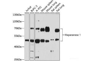 Western blot analysis of extracts of various cells using Heparanase 1 Polyclonal Antibody at dilution of 1:1000. (HPSE Antikörper)