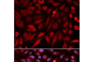 Immunofluorescence analysis of U2OS cells using SDCBP Polyclonal Antibody (SDCBP Antikörper)
