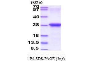 SDS-PAGE (SDS) image for Coxsackie Virus and Adenovirus Receptor (CXADR) (AA 20-237) protein (His tag) (ABIN5853079)