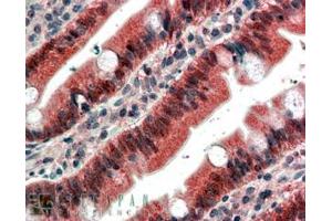 ABIN185351 (4µg/ml) staining of paraffin embedded Human Small Intestine. (FGFR1 Antikörper  (C-Term))