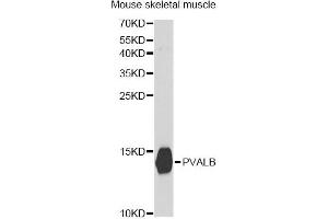 Western blot analysis of extracts of mouse skeletal muscle, using PVALB antibody (ABIN5971476) at 1:400 dilution. (PVALB Antikörper)