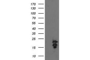 Western Blotting (WB) image for anti-Fibroblast Growth Factor 21 (FGF21) antibody (ABIN1498256) (FGF21 Antikörper)