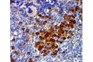 IHC testing of mouse spleen stained with CD63 antibody (MX49. (CD63 Antikörper)