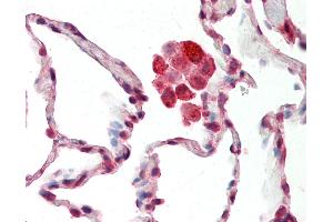 Anti-NDUFS8 antibody IHC staining of human lung. (NDUFS8 Antikörper  (C-Term))