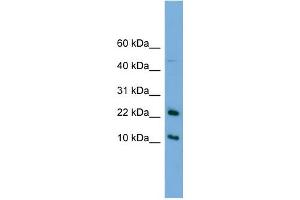 WB Suggested Anti-GM2A Antibody Titration:  0. (GM2A Antikörper  (N-Term))
