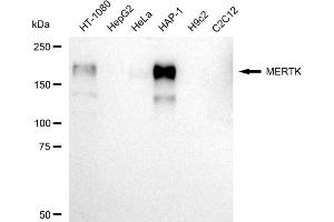 Western blotting analysis using MERTK antibody (ABIN7797812).