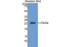 Western Blotting (WB) image for anti-Retinol Binding Protein 5, Cellular (RBP5) (AA 19-201) antibody (ABIN1860414) (Retinol Binding Protein 5 Antikörper  (AA 19-201))