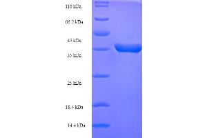 LINE-1 Type Transposase Domain Containing 1 (L1TD1) (AA 2-169) protein (His-SUMO Tag)