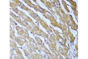 Immunohistochemistry of paraffin-embedded Human liver using IGF2BP3 Polyclonal Antibody at dilution of 1:100 (40x lens). (IGF2BP3 Antikörper)