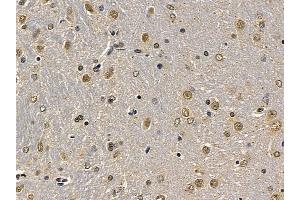 eEF2K Mouse Monoclonal Antibody at 1/100 staining rat brain tissue by IHC-P. (EEF2K Antikörper  (Internal Region))