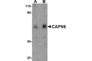 Western Blotting (WB) image for anti-Calpain 6 (CAPN6) (C-Term) antibody (ABIN1030308)