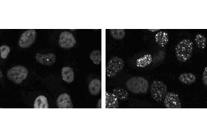 Immunofluorescent staining of HT1080 cells (ATCC CCL-121).