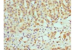 Immunohistochemistry of paraffin-embedded human adrenal gland tissue using ABIN7145593 at dilution of 1:100 (SULT2A1 Antikörper  (AA 1-145))