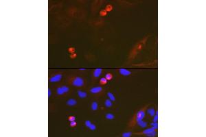 Immunofluorescence analysis of U-2 OS cells using T Rabbit mAb (ABIN7270916) at dilution of 1:100 (40x lens). (TACC3 Antikörper)