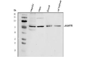Western blot analysis of AMFR using anti-AMFR antibody (ABIN4886455). (AMFR Antikörper  (AA 553-643))