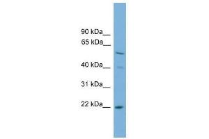 Western Blot showing UBE2T antibody used at a concentration of 1-2 ug/ml to detect its target protein. (Ube2t Antikörper  (N-Term))