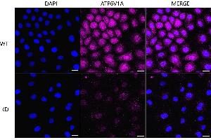 Immunocytochemical staining of HT- cells using ATP6V1A antibody (ABIN7797699), 1:1,000), Top panel: wild-type (WT), Bottom panal: ATP6V1A shRNA knockdown (KD).