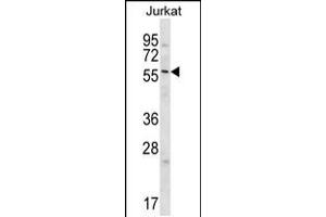 Western blot analysis in Jurkat cell line lysates (35ug/lane). (Glypican 3 Antikörper  (C-Term))