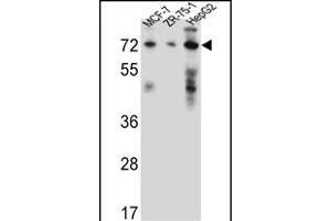 HSD17B4 Antibody (Center) (ABIN656447 and ABIN2845732) western blot analysis in MCF-7,ZR-75-1,HepG2 cell line lysates (35 μg/lane). (HSD17B4 Antikörper  (AA 341-370))
