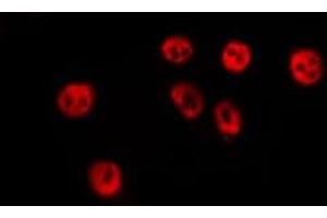 ABIN6276651 staining Hela by IF/ICC. (MITF Antikörper  (Internal Region))